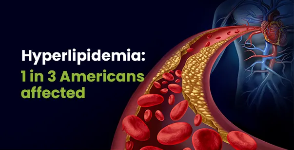 Hyperlipidemia causes, symptoms, and treatments post img