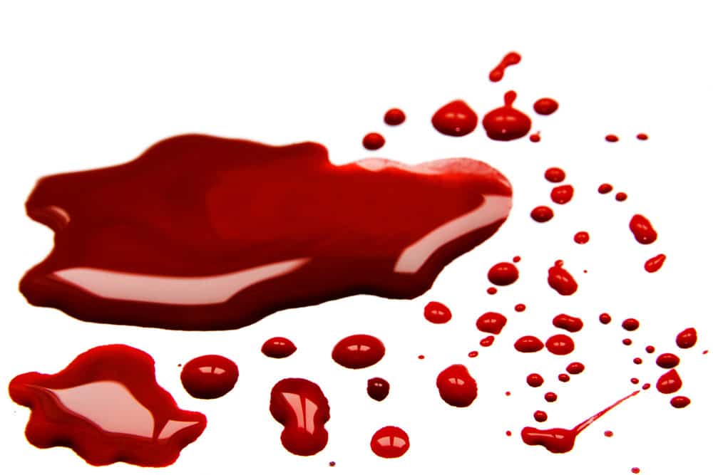 Blood Spatter