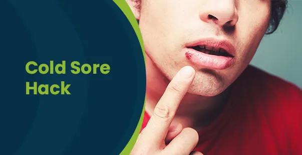 How to get rid of a cold sore as fast as possible post img