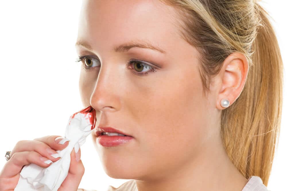 patient or victim bleeding from nose with a cotton