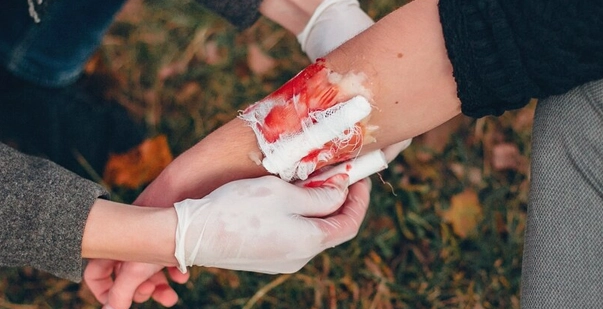 Complete guide to first aid for bleeding and how to treat it post img