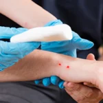 image for first aid for snake bites CPR Certification Online