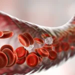 Hemostasis stages and how the process stops blood flow post img