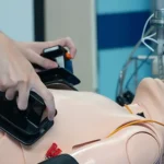 Synchronized Cardioversion Everything You Need to Know