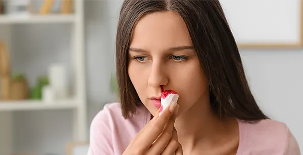 How to stop a nosebleed tips and treatment post img