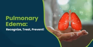 Pulmonary edema symptoms, causes, and treatment post img