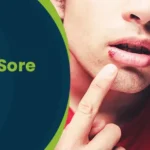 How to get rid of a cold sore as fast as possible post img