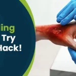 Scalding skin try this hack! Post img