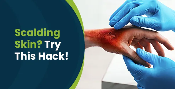 Scalding skin try this hack! Post img