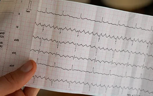 Illustration for AFib vs. VFib: Symptoms, Causes, and Life-Saving Treatments