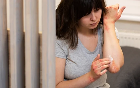 How to Treat a Burn : Diagnosis & Treatment