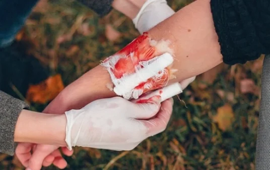 Complete guide to first aid for bleeding and how to treat it post img