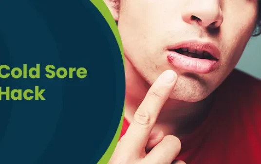 How to get rid of a cold sore as fast as possible post img