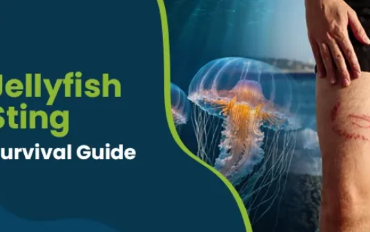 How to recognize and treat box jellyfish stings post img