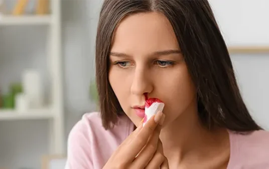 How to stop a nosebleed tips and treatment post img