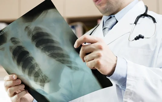 A Complete Guide to Cracked Ribs Diagnosis and Treatment