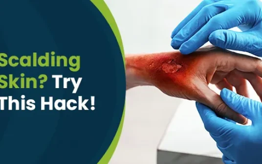Scalding skin try this hack! Post img