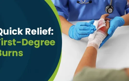 Illustration for First-degree Burn: Causes, Symptoms, and Treatment